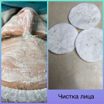 Механічна чистка обличчя
