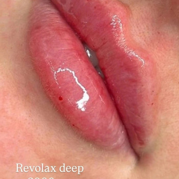 Revolax deep
