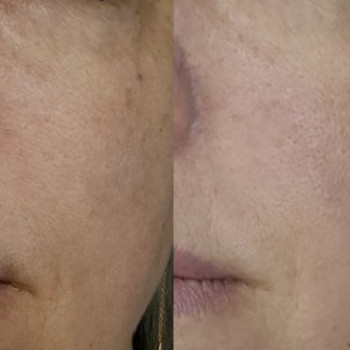 Фото с портфолио Анжела Краснюк