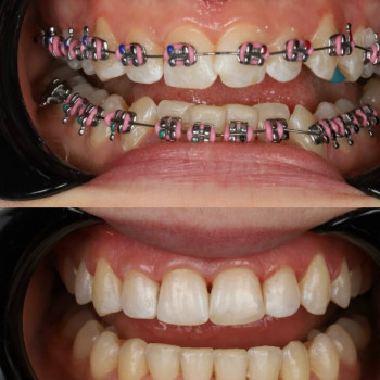 Фото с портфолио Dental Design Clinic