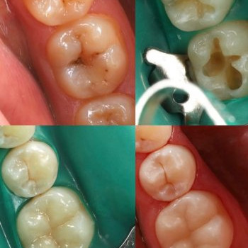 Фото с портфолио Dental Design Clinic