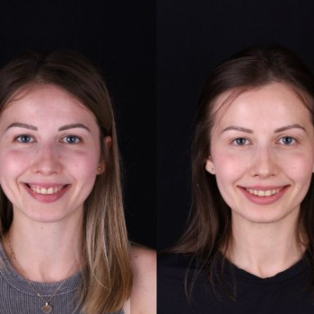 Фото с портфолио Dental Design Clinic