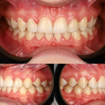Фото с портфолио Dental Design Clinic