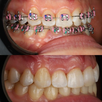 Фото с портфолио Dental Design Clinic