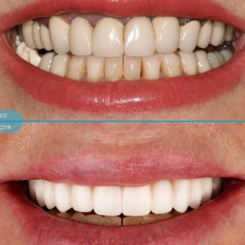 Фото с портфолио Happy Dental