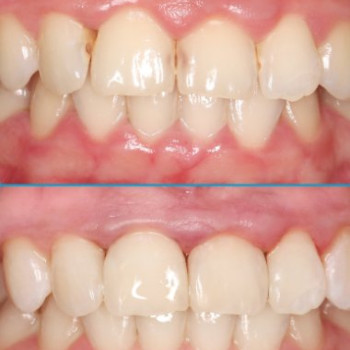 Фото с портфолио Happy Dental