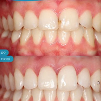 Фото с портфолио Happy Dental