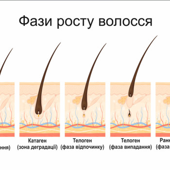 Фото с портфолио Тетяна Івасів