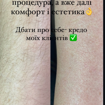 Фото с портфолио Тетяна Балабаннікова