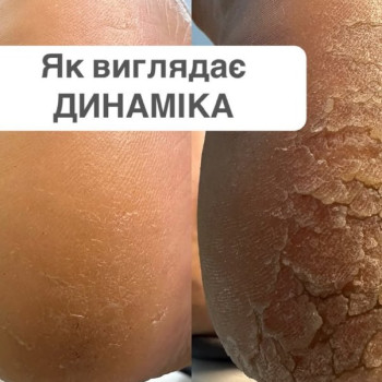 Фото с портфолио Анна Мудра