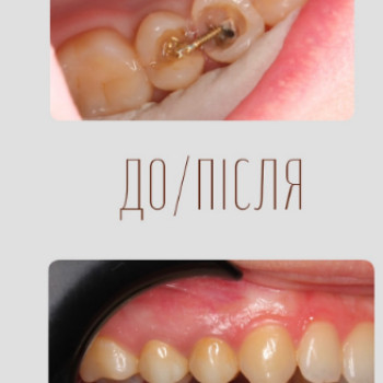 Фото с портфолио Ксенія Пархомець