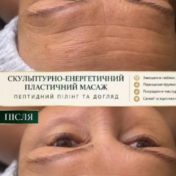 Фото с портфолио Тетяна Браіло
