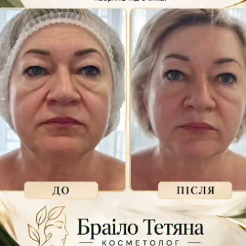 Фото с портфолио Тетяна Браіло