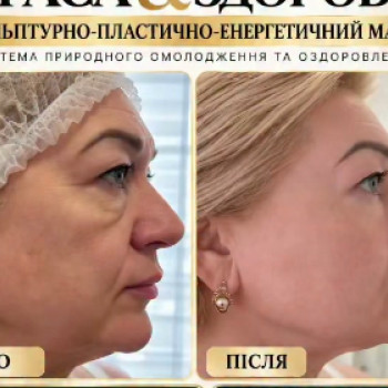 Фото с портфолио Тетяна Браіло