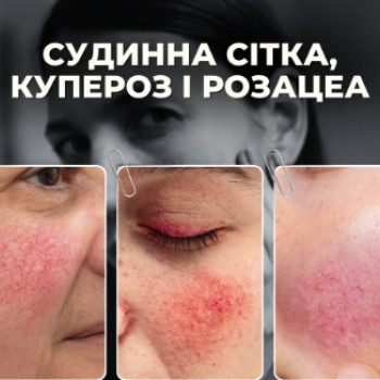 Фото с портфолио Лазерхауз