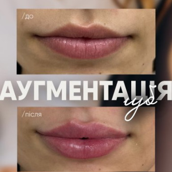 Фото с портфолио Есте Медикал