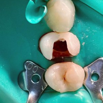 Фото с портфолио Сучасна стоматологія Dental Clinic