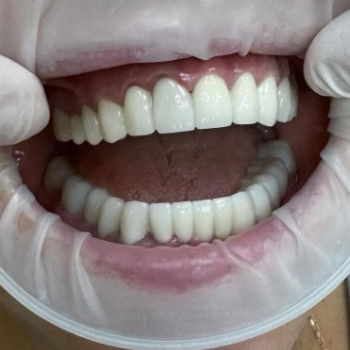 Фото с портфолио Сучасна стоматологія Dental Clinic
