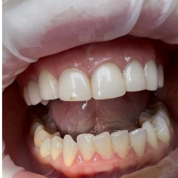 Фото с портфолио Сучасна стоматологія Dental Clinic