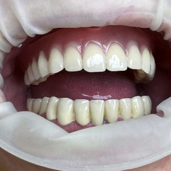 Фото с портфолио Сучасна стоматологія Dental Clinic
