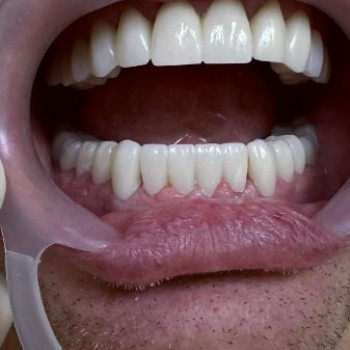 Фото с портфолио Сучасна стоматологія Dental Clinic
