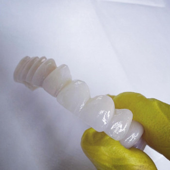 Фото с портфолио Сучасна стоматологія Dental Clinic