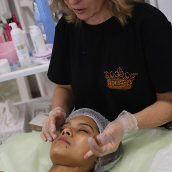 DERMAPEN Іспанія: EXOSOMAS PDRN NAD
