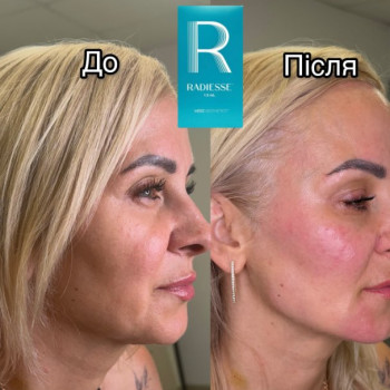 Фото с портфолио Юлія 