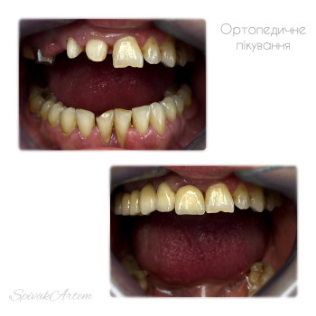 Фото с портфолио Артем Співак