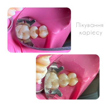 Фото с портфолио Артем Співак