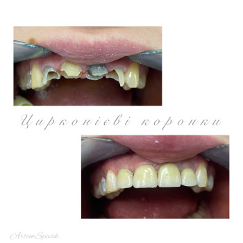 Фото с портфолио Артем Співак