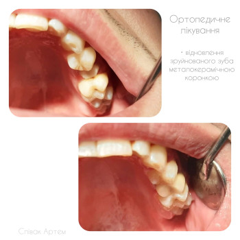 Фото с портфолио Артем Співак