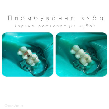 Фото с портфолио Артем Співак