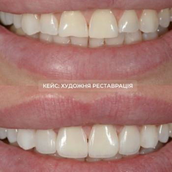 Фото с портфолио Галина Макогон