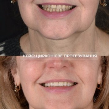 Фото с портфолио Галина Макогон