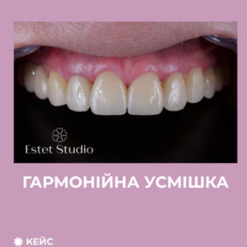 Фото с портфолио Галина Макогон
