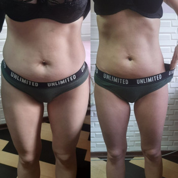 Фото с портфолио Майстерня краси та здоров'я SLIM