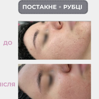 Фото с портфолио Gigi Laser