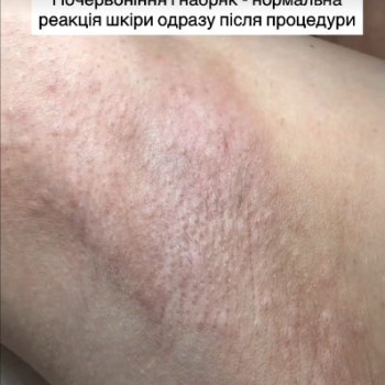 Фото с портфолио Zaya