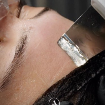Фото с портфолио Al's Hair Clinic