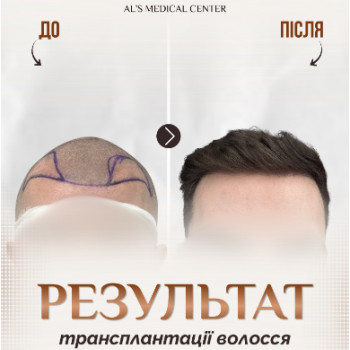 Фото с портфолио Al's Hair Clinic
