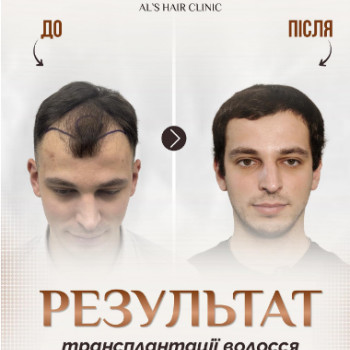 Фото с портфолио Al's Hair Clinic