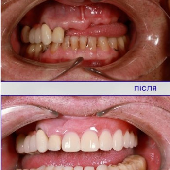 Фото с портфолио Maestro Smile