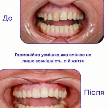 Фото с портфолио Maestro Smile