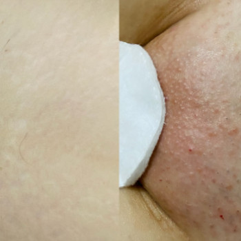 Фото с портфолио Алла Помін