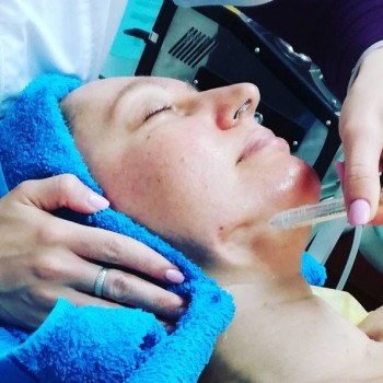 Фото с портфолио Линия