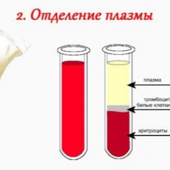 Плазмолифтинг 1-й области (8,5 мл)
                    Медицинский центр Estetic Medical Одесса