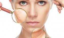 Инъекции Ботокс (Allergan, США) Косметологический центр Клеопатра Харьков