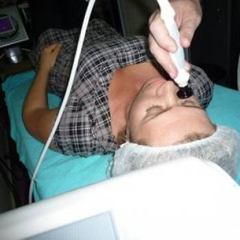  R-F лифтинг лица