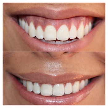 Фото с портфолио Светлана Колесник 